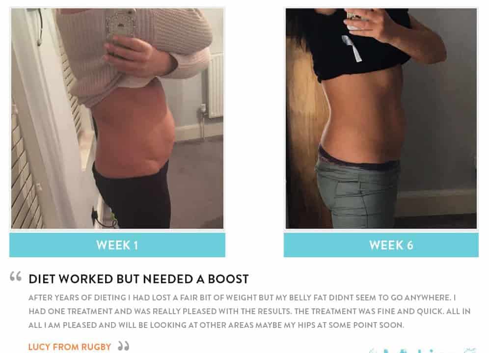 Before and After Dieting West Hampstead