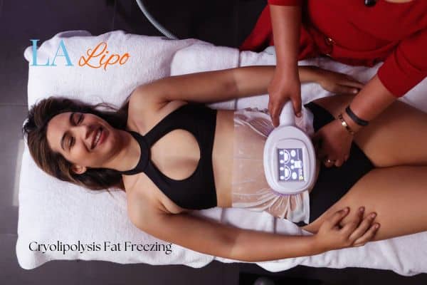 woman getting cryolipolysis West Hampstead