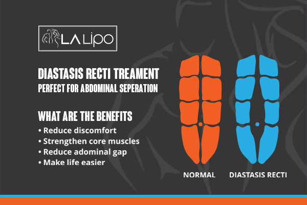 When Should You Consider Professional Help for Core Recovery West Hampstead