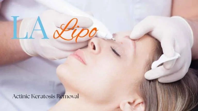 Woman receiving Actinic Keratosis Removal Treatment West Hampstead