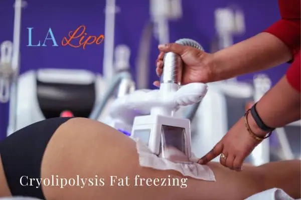 women getting fat freezing West Hampstead