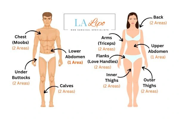 LA LIPO Cryolipolysis Areas West Hampstead