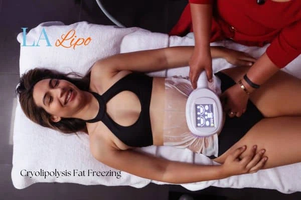 woman getting cryolipolysis West Hampstead