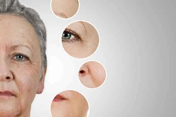 HIFU Facelift West Hampstead from LA LIPO