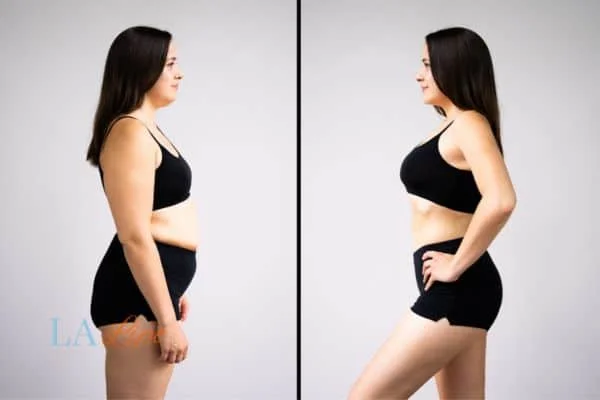 link between body image and mental health West Hampstead