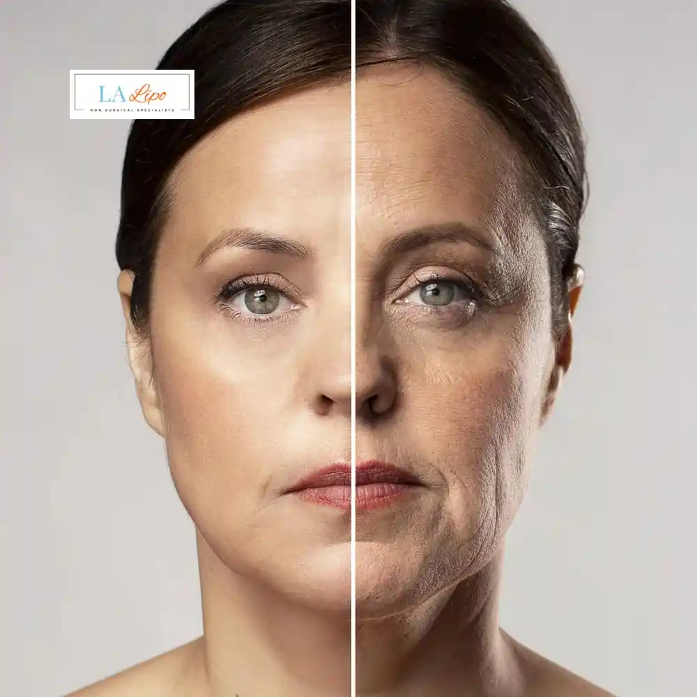 How Can You Tell If Non-Surgical Skin Tightening Is Right for You West Hampstead?