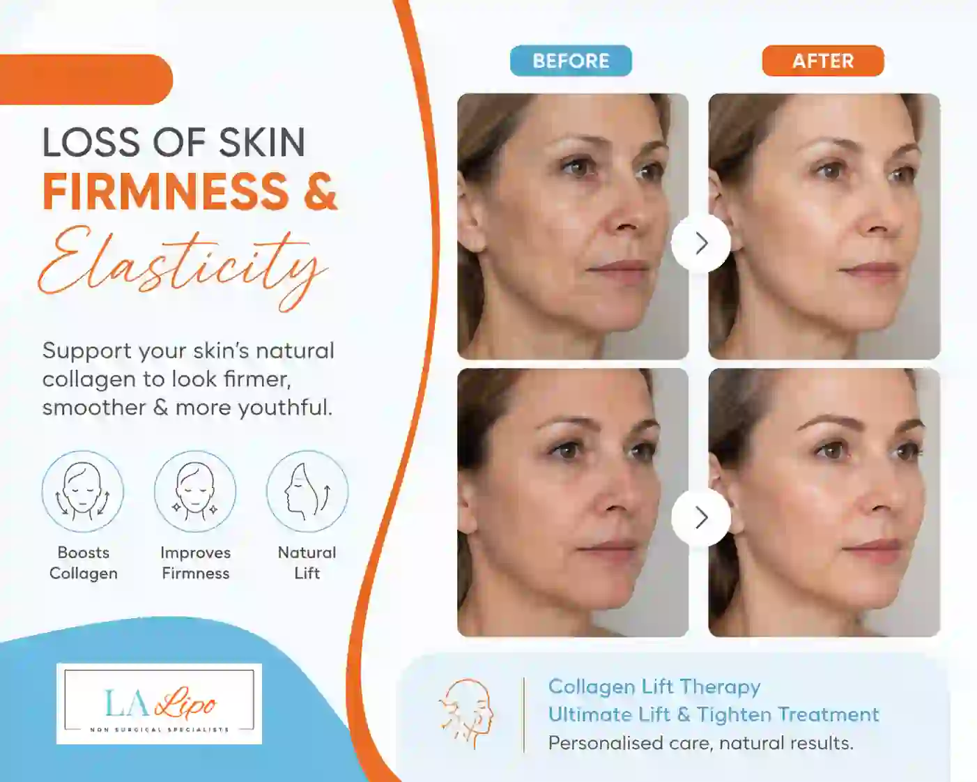 Sign #7: Loss of Skin Firmness and Elasticity West Hampstead